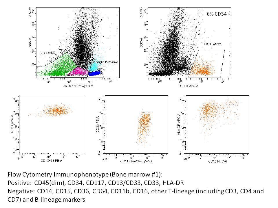 Bone marrow flow cytometry #1: There are approximately 6% CD34+ myeloblasts by flow cytometry.